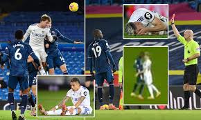 Agora também estamos expandindo através do modelo de franquia. Leeds 0 0 Arsenal Gunners Hold On For A Point After Nicolas Pepe Is Sent Off For Petulant Headbutt Daily Mail Online