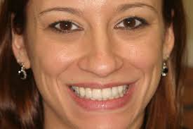 Cosmetic Dentistry in Virginia Beach, VA