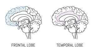 Image result for Frontal Lobe