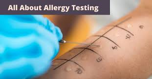 Image result for Allergy Screening