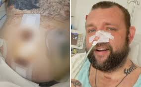 Symptoms of mould exposure: Queensland man spends three months in coma  after suffering necrotising pancreatitis