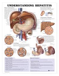 Understanding Hepatitis Chart Poster Laminated