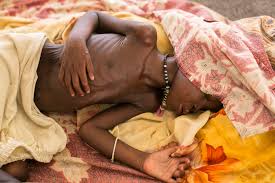 Image result for Two children die of hunger in Africa