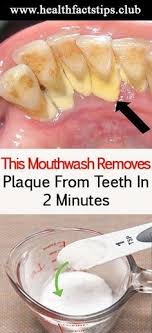 This Is How To Prepare This Mouthwash You Will Need 1 Tablespoon Baking Soda Teaspoon Of Salt Cup Hydrogen Per Teeth Health Health Remedies Healthy Teeth
