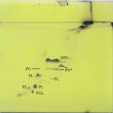 Soil is a mixture of organic matter, minerals, gases, liquids, and organisms that constitutes the upper layer of earth in which plants grow. Streptomyces Monashensis Sp Nov A Novel Mangrove Soil Actinobacterium From East Malaysia With Antioxidative Potential Scientific Reports