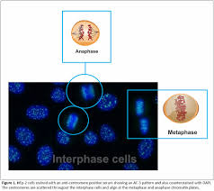 Image result for ANA Staining Pattern