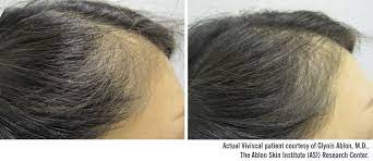 Pin On Hair