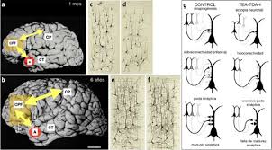 Qué se evidencia en remedio y estudios. Bases Neurobiologicas Del Trastorno Del Espectro Autista Y Del Trastorno Por Deficit De Atencion Hiperactividad Diferenciacion Neural Y Sinaptogenesis Neurologia Com