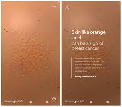 Unlike traditional forms of breast cancer, inflammatory breast cancers do not develop unusual lumps within the affected breast. Breast Cancer Foundation Pre Check App To Look For Breast Cancer