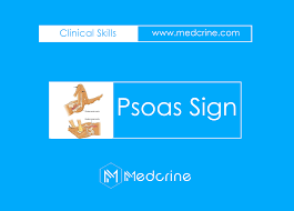Image result for Psoas Sign