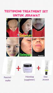 Follow to stay updated on all things beautiful. Tips Kecantikan Mary Kay Produk Untuk Jerawat Kelebihan Botanical Effects Mary Kay