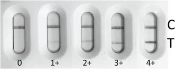 We observe both test and control lines when we run only. Quantification Of Sars Cov 2 Antibodies With Eight Commercially Available Immunoassays Sciencedirect