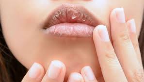 Check spelling or type a new query. Jangan Cuek 5 Masalah Di Bibir Ini Tunjukkan Kondisi Kesehatanmu Cantik Tempo Co