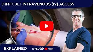 Image result for Difficult Intravenous Access in Children