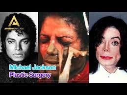 Born michael joseph jackson on august 29, 1958, he was called 'mj' by his fans and 'the king of pop' by the music industry, in recognition of his incredible success as an entertainer, with contributions to the world of music, fashion and dance. Michael Jackson Plastic Surgery Before And After Photos Slideshow Youtube