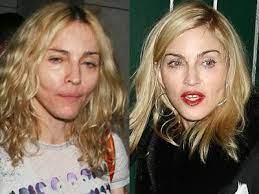 Jul 26, 2021 · 26. Madonna Celebs Without Makeup Celebrity Surgery Celebrities