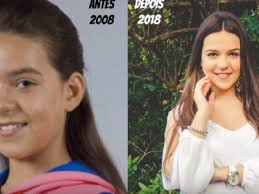As últimas novidades de pedro teixeira morangos com açúcar disponíveis aqui e muito mais. Morangos Com Acucar 6 Antes Depois Dioguinho Blog