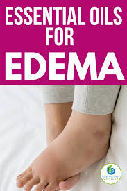 Pin On Essential Oils