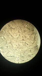 Bone Osseous Connective Tissue Zoomed Out Histology Slides Bone Tissue Plates