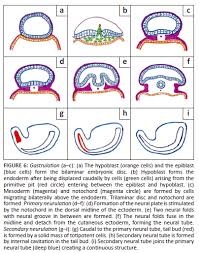 Image result for Spinal Dysraphism