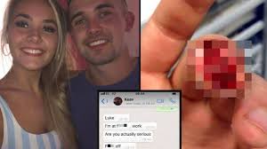 Louis businesses, organizations, and institutions are having fun with their fans today. Man Pulls Ultimate April Fool S On Girlfriend With Severed Finger Prank Ladbible