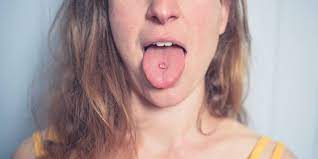 Tongue Piercings Complete Guide With Types Prices And Aftercare 2020