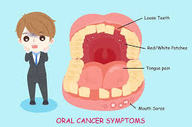 Lip cancer is responsible for about 4,000 cases of oral cancer yearly. Oral Cancer Treatment Bangalore Mouth Tumor Surgery Karnataka