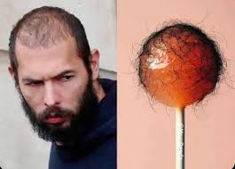Angry Fans share photo of Andrew Tate comparing him to a dirty lollipop  going viral online after he made fun of his followers for being poor for  missing out