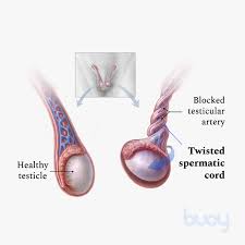Because your pain keeps coming back and there might be some swelling, you should tell a parent and call your doctor's office right away. Testicular Torsion Symptoms Diagnosis And Treatments