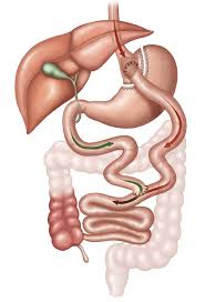 Gastric Bypass Roux En Y Gastric Bypass Brisbane Obesity Clinic