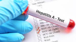 Ketika tangan kita menyentuh air tersebut dan kita tidak mencuci tangan kemudian menyentuh makanan maka virus itu bisa masuk ke dalam tubuh. Penyebab Hepatitis A Ketahui Penularan Gejala Dan Pencegahannya Hot Liputan6 Com