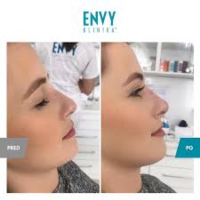 ENVY-klinika estetickej mediciny