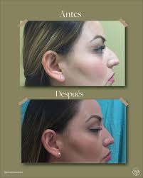 Dr.Carlo Pedroza Mendez