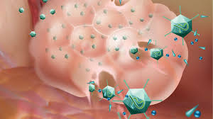 Tactical Maneuvers The Scientist Magazine Cancer Cancer Cell Immunotherapy