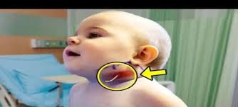 Little Girl Kept Scratching Her Neck. Doctors Were Shocked When They  Discovered The Reason!