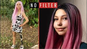 I Survived Shark Attack At Age 17