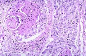 Receive free shipping on orders $35+! Pulmonary Pathology