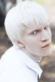 Piebald deer can have white patches of hair but otherwise is colored normally. Most Popular Tags For This Image Include Albino Eyes Russian Model White Hair And White Skin Albino Model Albino Human Albino Men