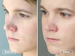 To help prevent this, try to not rub your eyes so much, and never touch your eyes with dirty hands. I Tried A Lash Perm And Here S What You Need To Know Self