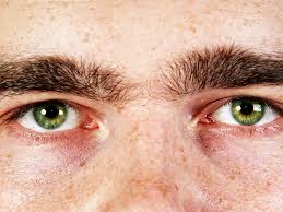 Image result for Freckled skin