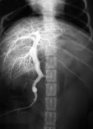Portosystemic shunts in golden retriever puppy. Portosystemic Liver Shunts In Dogs And Cats