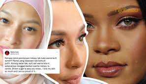 Penjagaan Kulit Tona Gelap, Pakar Saran Perjuangkan Diri Sendiri Dan Jangan  Malu. Betullah Kata Nabila Huda!