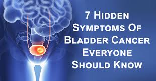 More than 90% of women diagnosed with endometrial cancer experience irregular bleeding. 7 Hidden Symptoms Of Bladder Cancer Everyone Should Know David Avocado Wolfe