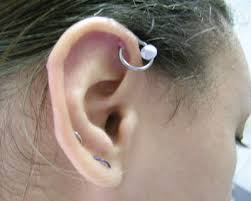 Complications Of Body Piercing American Family Physician