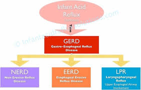 Infant Gerd Symptoms