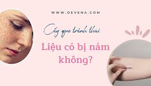 Giải đáp: Cấy que tránh thai có bị nám da không?