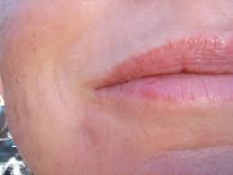 Viruset finnes i sår og sårvæske, og overføres ved direkte kontakt med partners slimhinner på munn, lepper, kjønnsorgan og. Norges Storste Permanent Makeupblogg Info Om Herpes Simplex Kjipt Virus