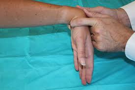 Image result for Carpal Compression Test