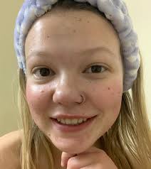 How to clean burnt pans?