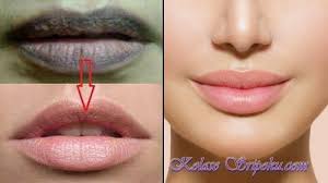 Bibir Kamu Hitam Kaya Aspal Begini Cara Mencerahkanya Cukup Dengan 7 Bahan Murah Ini Halaman All Sriwijaya Post